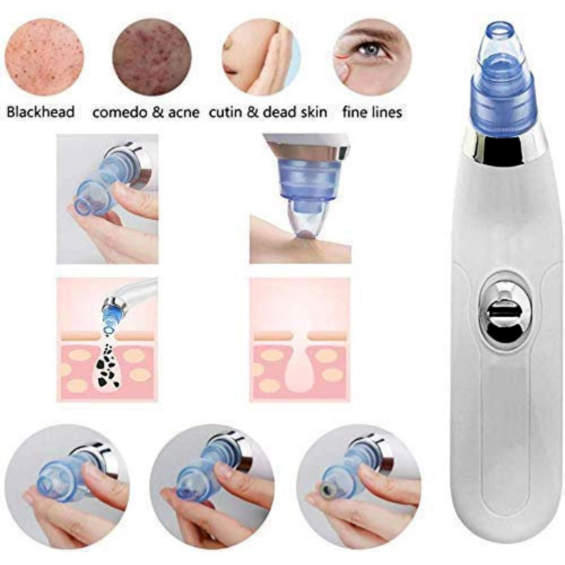 DermaSuction Multifunctional Cleaning Instrument For Pore Acne Pimple Removal and Vacuum Suction Facial Pore Cleaner Rs 1599